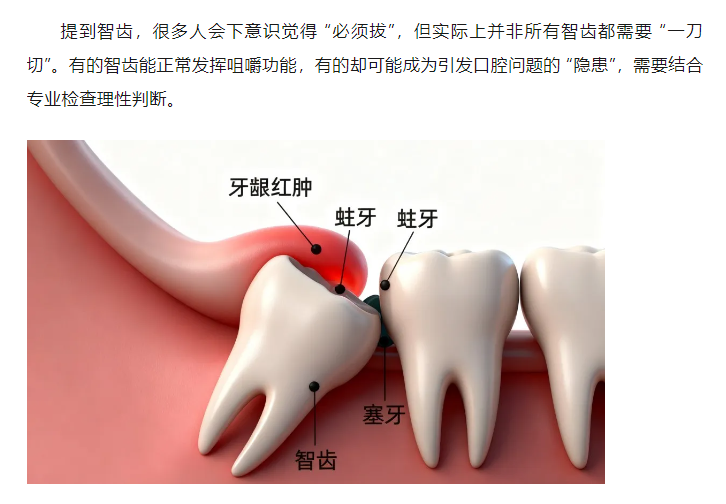 智齿是否都要拔？这份科学指南帮你理清