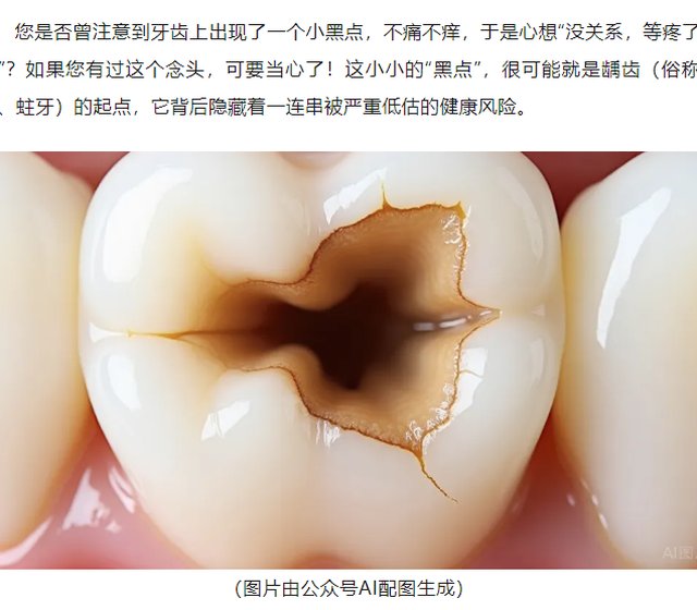 小洞不补，大洞吃苦：别把牙齿上的“黑点”不当回事！