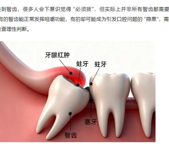 智齿是否都要拔？这份科学指南帮你理清