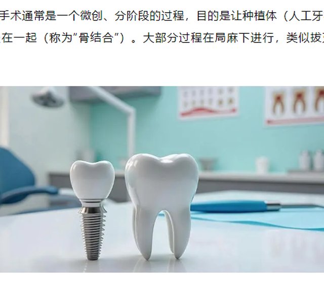 一次说清楚种植牙的流程及日常维护