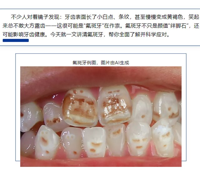 90% 人都搞错了，氟斑牙不是蛀牙！别再瞎治了！